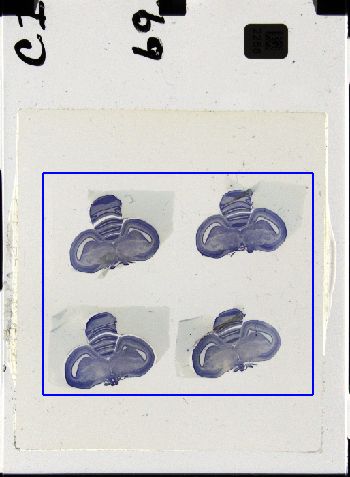 Media type: image; Special Collections 3298   shows specimen_part histological serial section;
